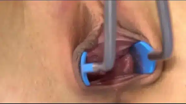 Extreme Czech Blonde Vagina Gaping